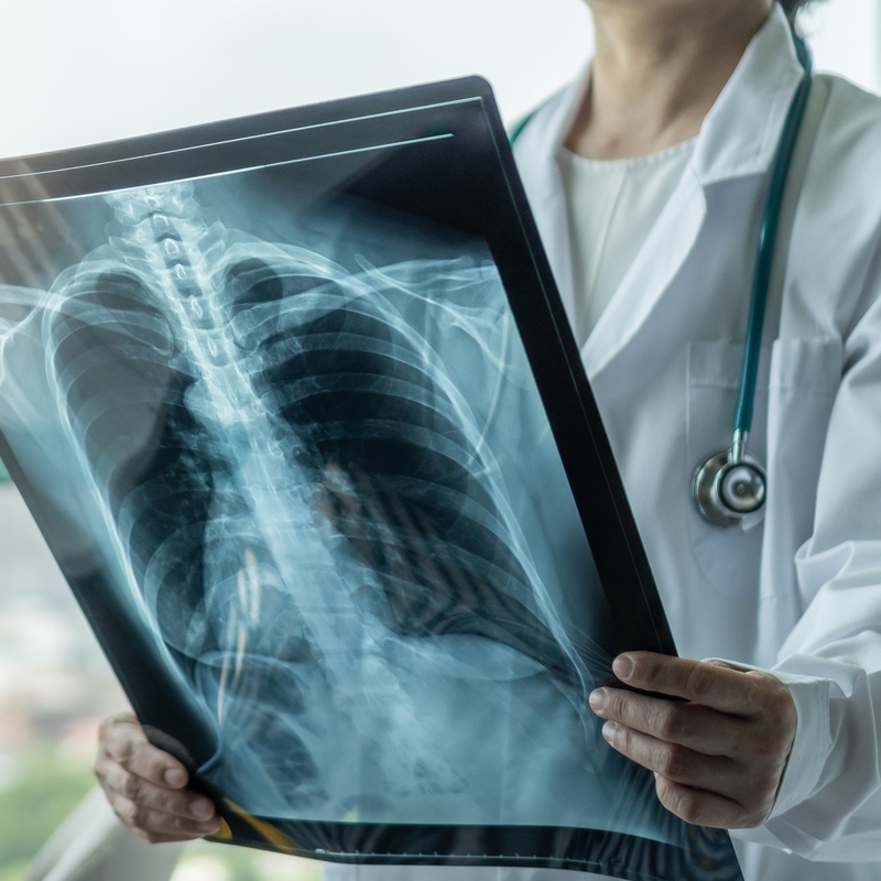 Neumonología Clínica